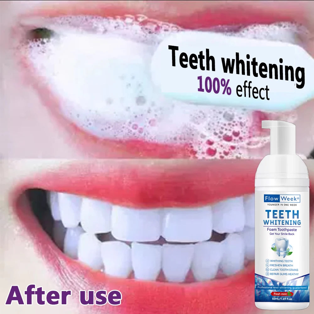FlowWeek Teeth Whitening Mousse Remove Oral Odor Dental Calculus Tooth-Sokohewani Ventures